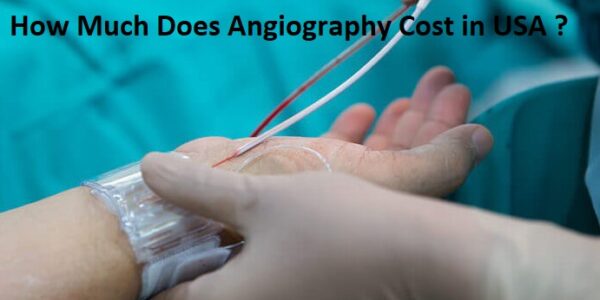 How Much Does Angiography Cost in USA
